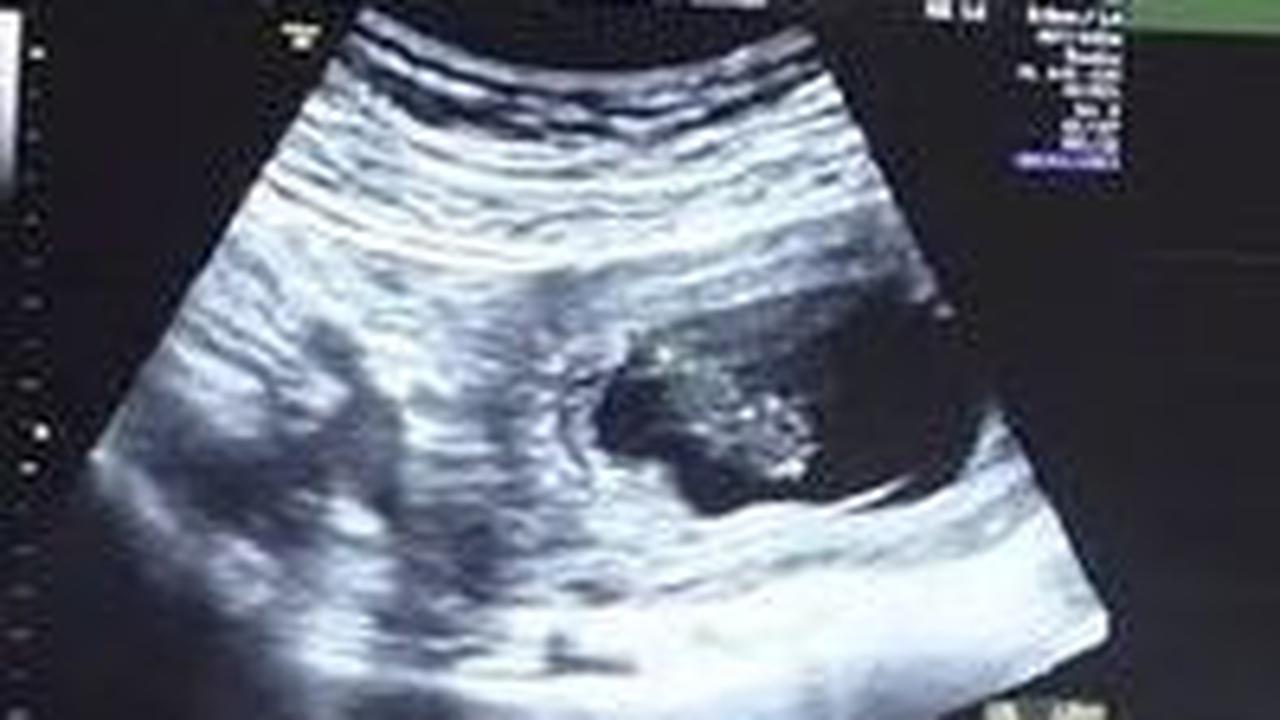 Melakukan Inseminasi