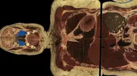 Reka Ulang 'Manusia' dari 5.000 Irisan Organ Tubuh