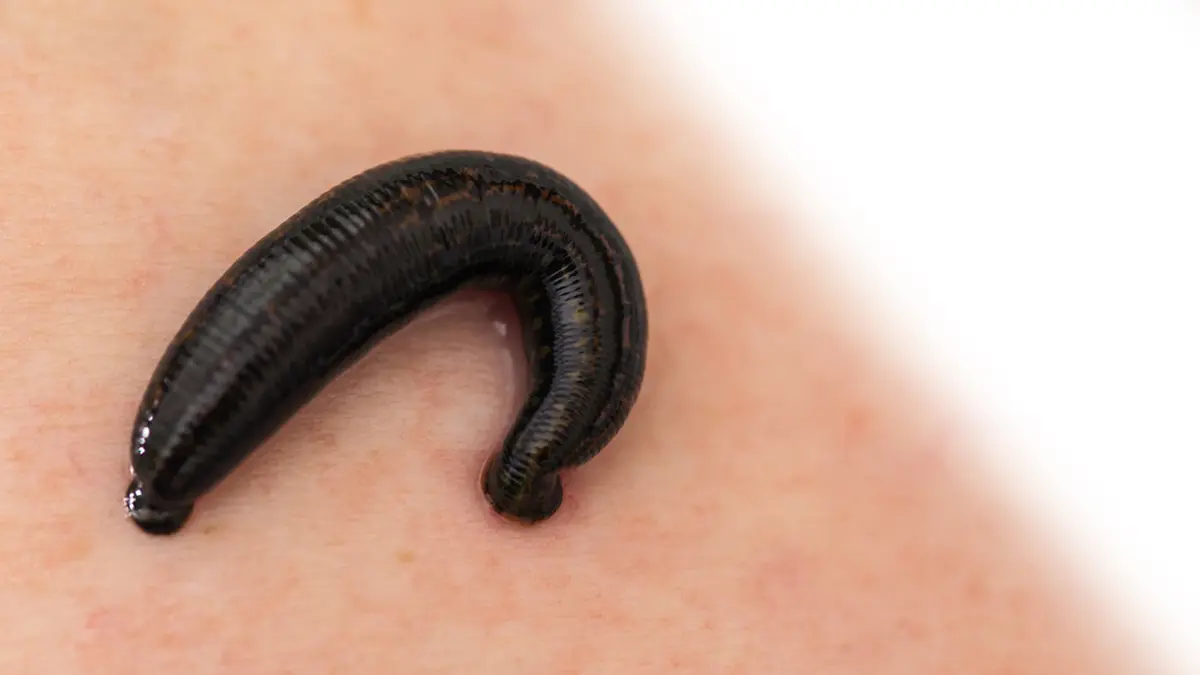 7 Arti Mimpi Digigit Lintah Yang Menjadi Pertanda Baik Maupun Buruk -  Lifestyle Fimela.com