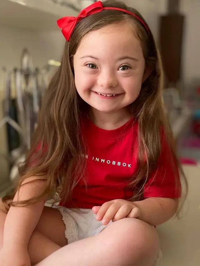 francesca model down syndrome berusia 4 tahun