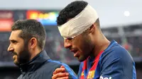 Terkapar, Gelandang Brasil Barcelona Absen 4 Pekan
