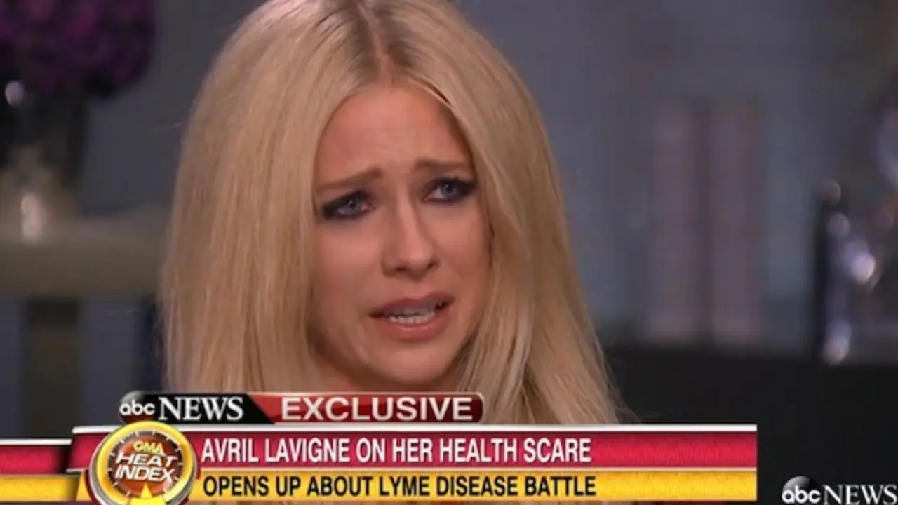Dalam wawancara dengan Good Morning America, Avril Lavigne tak mampu menahan tangis saat menceritakan tentang penyakitnya.