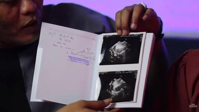 7 Momen Bahagia Sule dan Nathalie Holscher Pamerkan Hasil USG