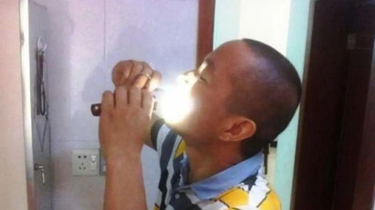 Pria Miskin Angkat Sendiri Tumor di Mulutnya Gunakan Tangan
