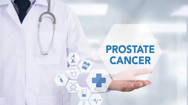 Terobosan Baru dalam Penanganan  Kanker Prostat