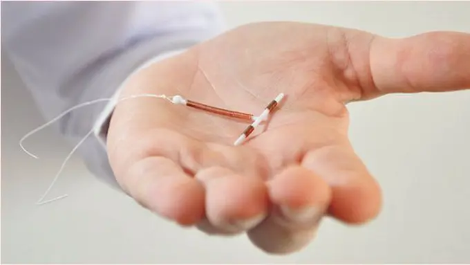 Pakai IUD sebagai alat KB/copyright Shutterstock.com