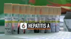 Petugas Dinkes Kota Depok mendirikan Pos Pamantau Hepatitis di SMPN 20. Sebelumnya puluhan siswa SMPN 20 Depok terserang Hepatitis. Tim akan mengambil sampel darah dan makanan dari siswa, guru, dan pegawai sekolah.
