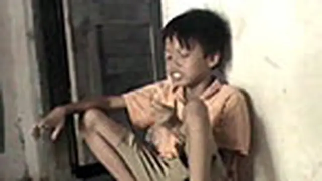 Bocah Gangguan Kelamin Ganda Butuh Uluran Tangan