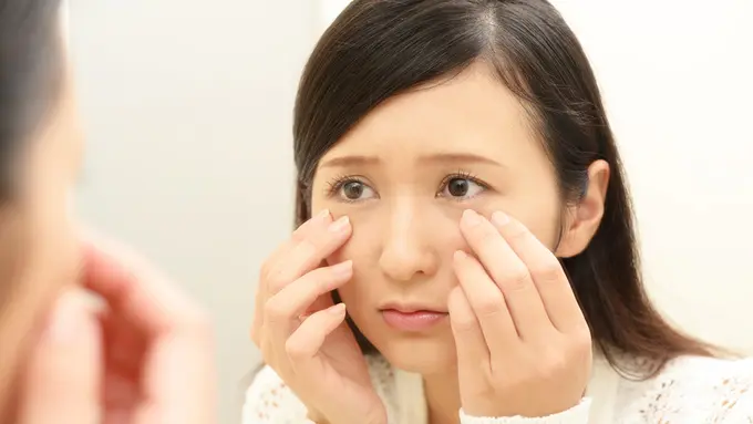 Wajib Tau! 5 Masalah Kulit yang Sering Dialami Perempuan