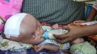Bayi asal Bombana, Sultra, itu mengidap hidrosefalus dan kini dirawat kakek dan neneknya. (Liputan6.com/Eka Hakim)
