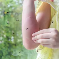 Golongan Darah, Warna Pakaian, dan Lainnya Bisa Jadi Alasan Kamu Sering Digigit Nyamuk/copyright shutterstock/Kwangmoozaa