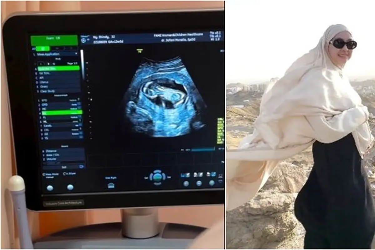 6 Potret Kakak Ria Ricis Umumkan Kehamilan Kedua, Baby Bump Mulai Terlihat