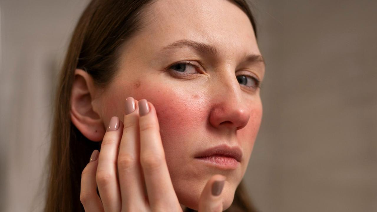 Kulit Kering dan Dehidrasi Itu Beda, Ini Penjelasan Lengkap Ahli Dermatologi