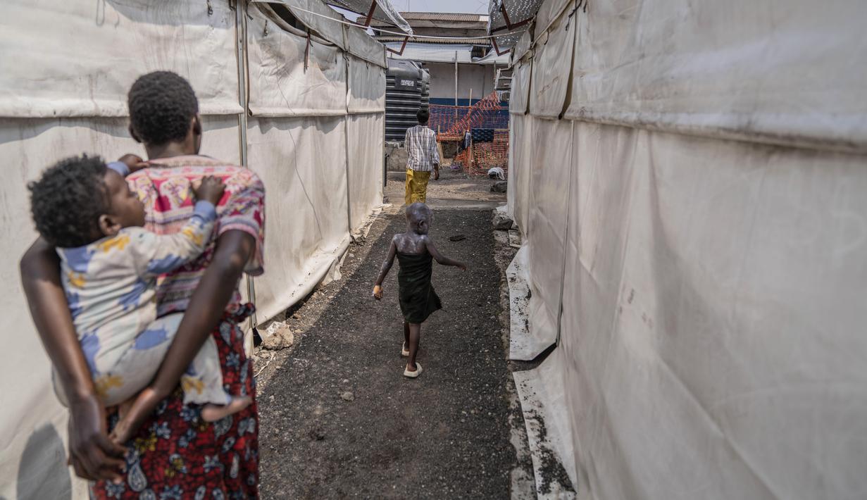 Sebelumnya, Organisasi Kesehatan Dunia (WHO) telah menyatakan wabah mpox yang sedang berlangsung di Kongo dan tempat lain di Afrika sebagai keadaan darurat global. (AP Photo/Moses Sawasawa)