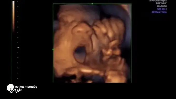 Ajaib! Janin Ini Beri Respon Saat Diperdengarkan Musik Klasik