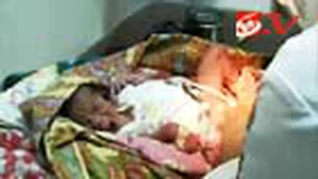 Duh, Bayi Terlahir Tanpa Dinding Perut