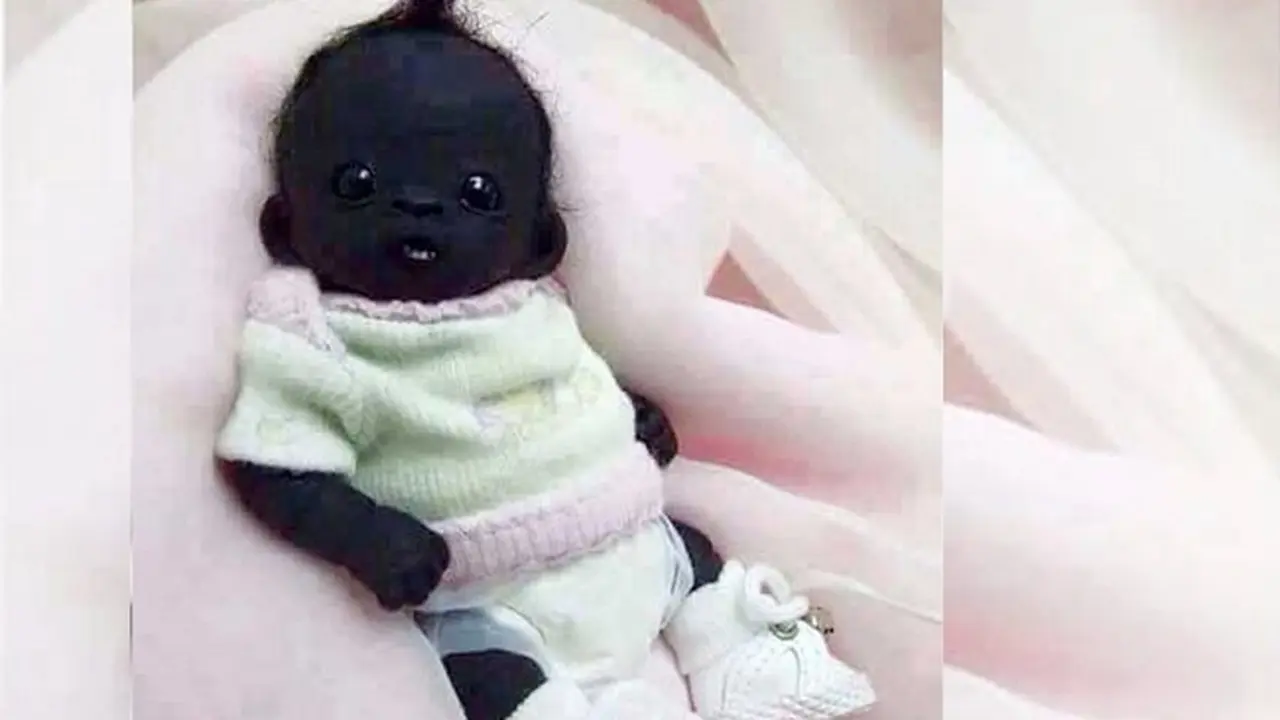 Bayi Berkulit Paling Legam Ini Gegerkan Publik di Socmed