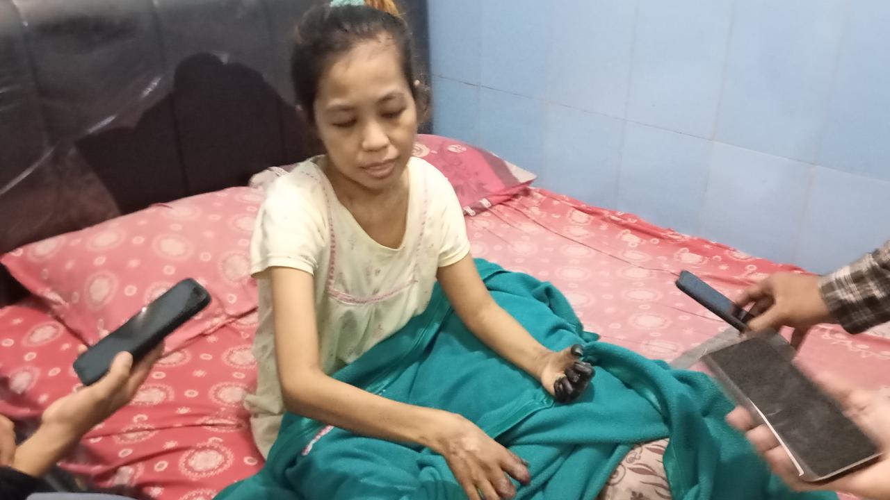 Nestapa TKI Jember Diduga Korban Malapraktik RS di Singapura: Operasi Bisul Malah Koma, Kaki Tangannya Gosong