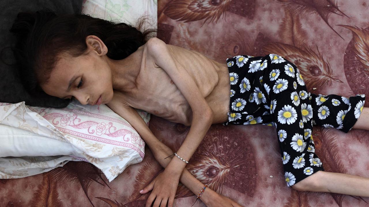 FOTO: Potret Pedih Mariam Anak 9 Tahun, Korban Kelaparan Gaza