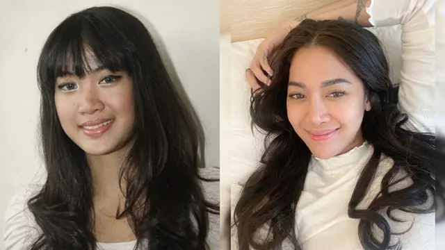 Potret Penyanyi Cantik Sebelum dan Sesudah Tanam Benang