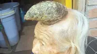 Nenek 87 Tahun Bertanduk Kerbau Hebohkan Publik