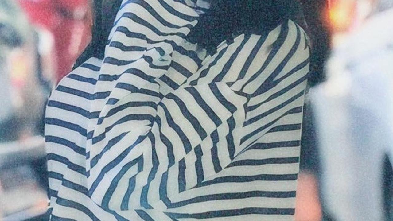 Disebut Mirip Ivan Gunawan Setelah Operasi Hidung, Intip Transformasi Cimoy Nuraini