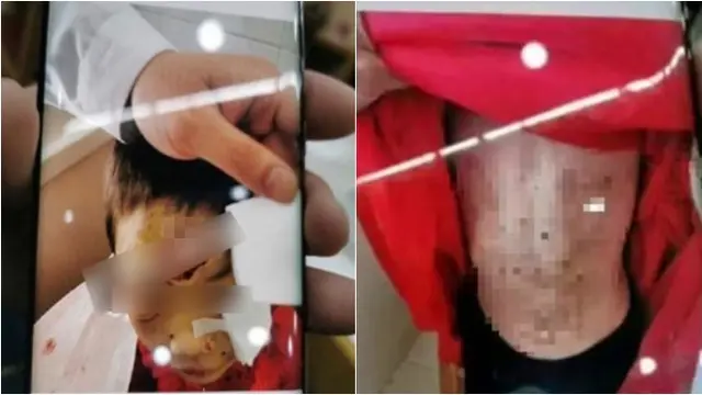 Potret kondisi sang anak korban KDRT