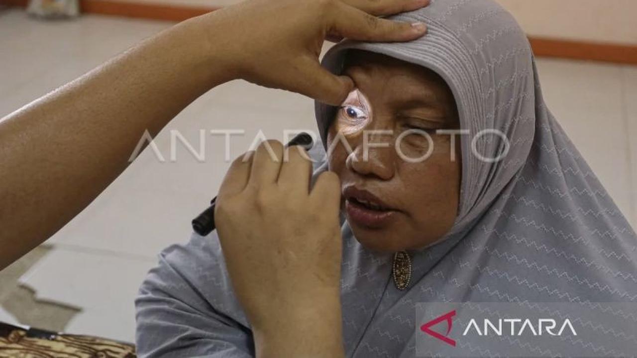 Waspada, Penggunaan Obat Tetes Mata Steroid Sembarangan Bisa Picu Katarak Dini