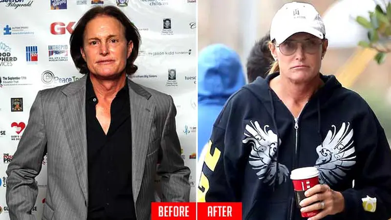 Ilustrasi Bruce Jenner