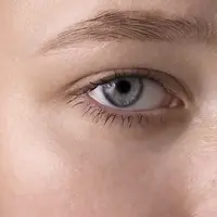 Glaukoma adalah kondisi yang menyerang penglihatan. (Foto: Freepik)