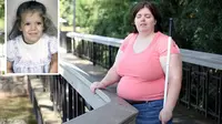 Terobsesi Menjadi Orang Buta, Wanita Ini Melakukan Hal Nekat