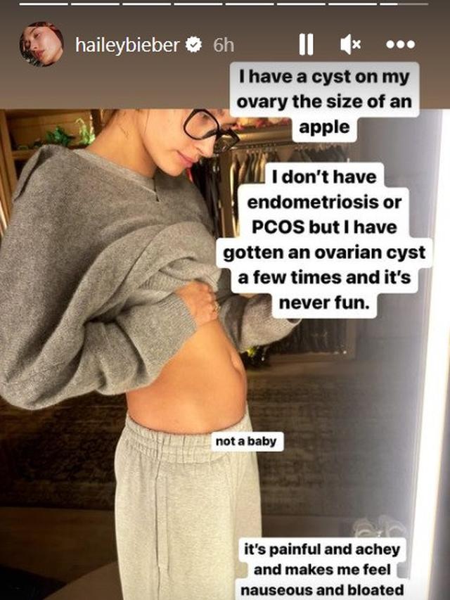 Unggahan Hailey Baldwin. (Instagram/ haileybieber)