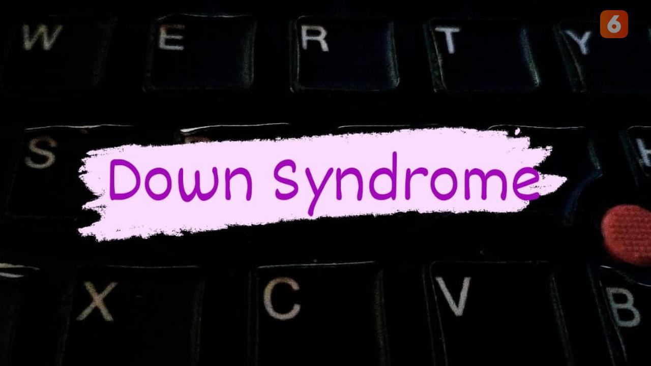 Down Syndrome