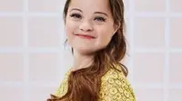 Katie Meade, Model Down Syndrome Pertama untuk Produk Kecantikan
