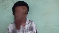 Pemuda 34 tahun warga Garut, Jawa Barat, memiliki tumor yang menutupi mata sebelah kanan hingga sebesar buah pepaya. (Liputan6.com/Jayadi Supriadin)