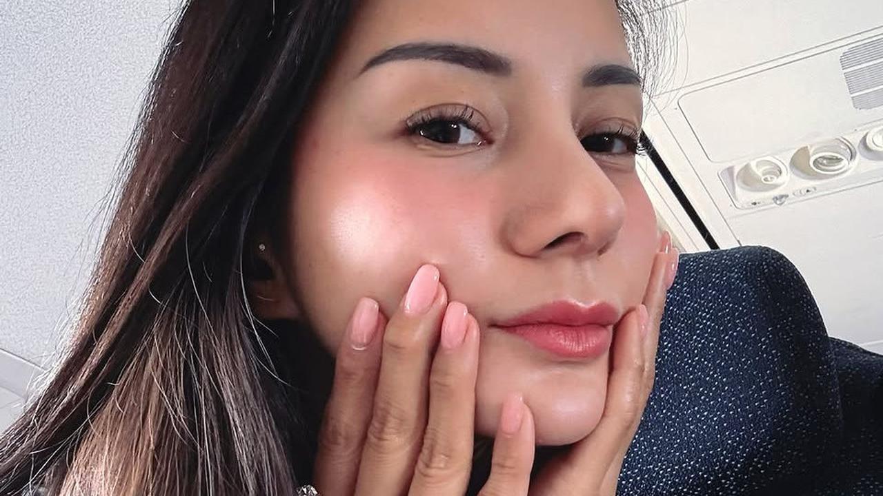 Potret Terbaru Kirana Larasati yang Kini Punya Hidung Mancung, Akui Jalani Prosedur Operasi Plastik di Thailand Agar Lebih Cantik