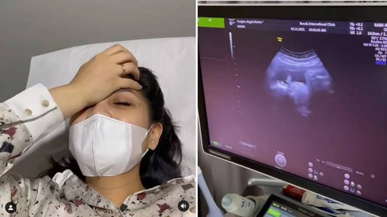 Nagita Slavina Melahirkan Bulan November, Ini 7 Momen USG yang Perlihatkan Buah Hati