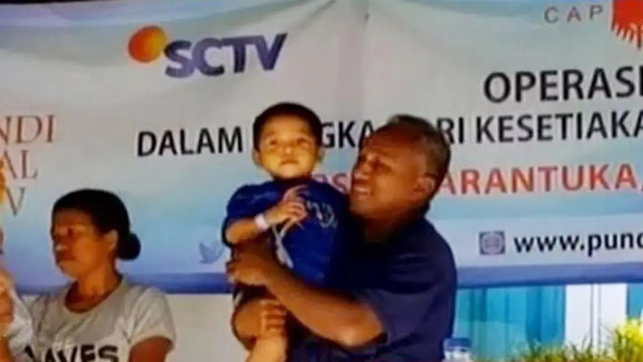 VIDEO: Operasi Hernia Gratis Pundi Amal SCTV di NTT