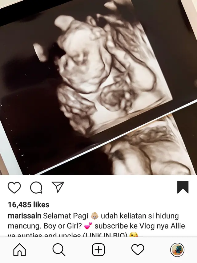 Instagram Marissa Nasution
