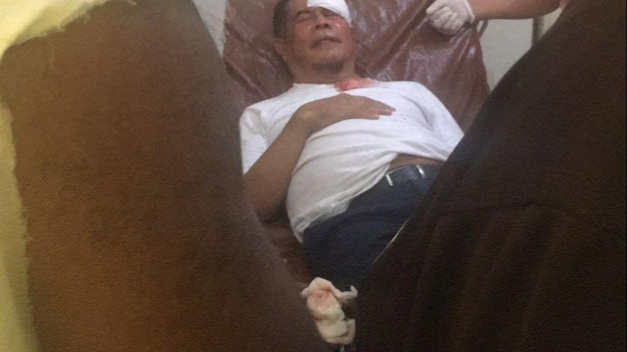 Muka Pj Gubernur Papua Berdarah Kena Lempar Batu Saat Iring-Iringan Jenazah Lukas Enembe di Sentani