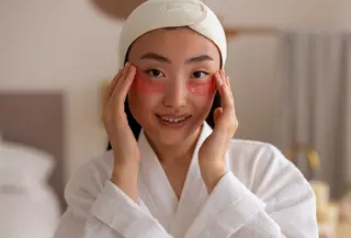 Dark circles atau periorbital hyperpigmentation bisa dipicu oleh kelelahan, kurang tidur, paparan sinar matahari, faktor genetik, hingga dehidrasi. Meski bukan masalah kesehatan yang serius, banyak orang ingin mengurangi tampilannya demi menunjang rasa percaya diri.(foto/dok: freepik)