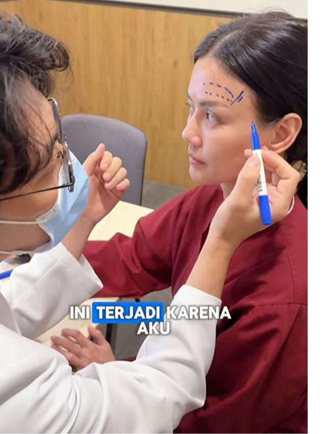 6 Potret Nita Gunawan Jalani Operasi Transfer Lemak ke Wajah Usai BB Turun 10 Kg