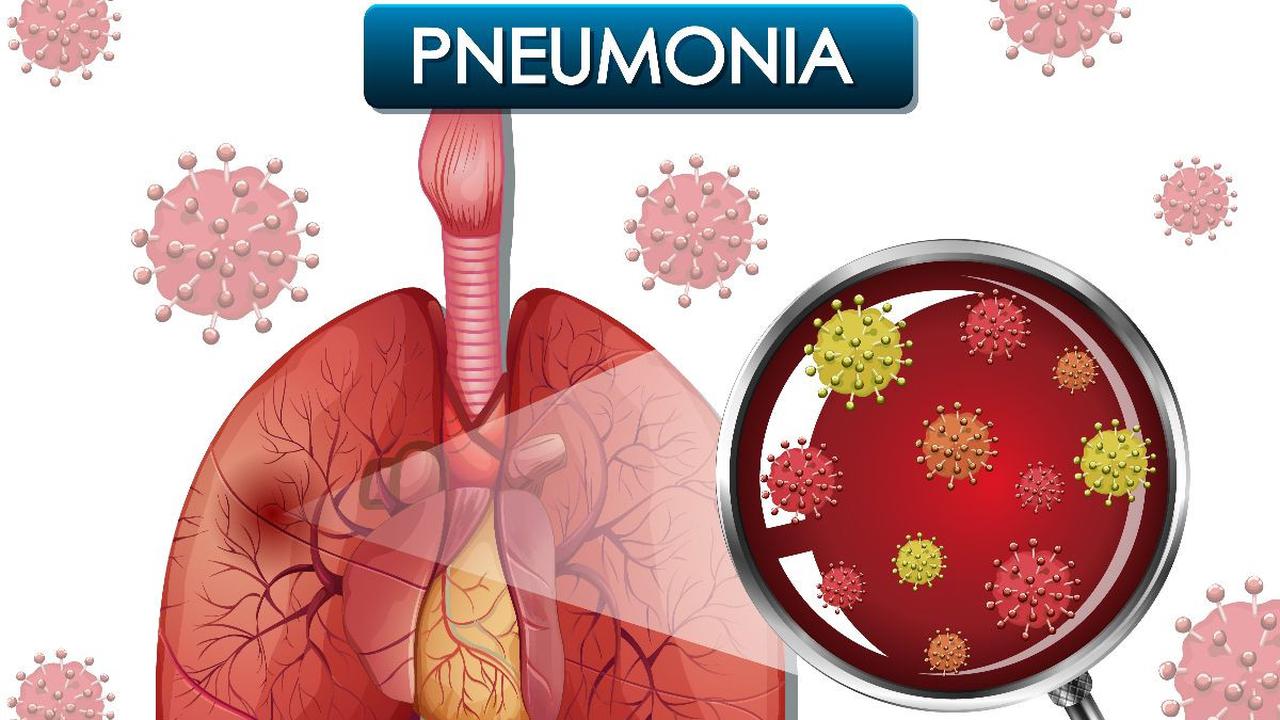 Apa Itu Pneumonia?<br>