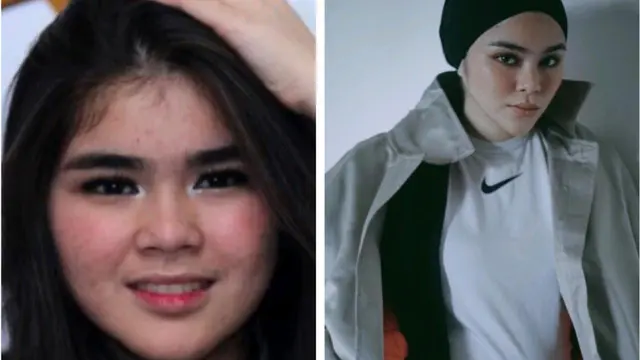 Transformasi 4 Personel Girlband Blink Dulu Vs Kini