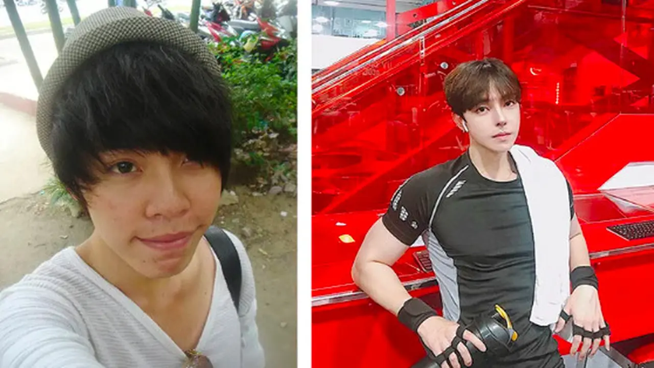 Ditolak Kerja karena Kurang Ganteng, Pria Nekat Operasi Plastik hingga Mirip Idol Kpop