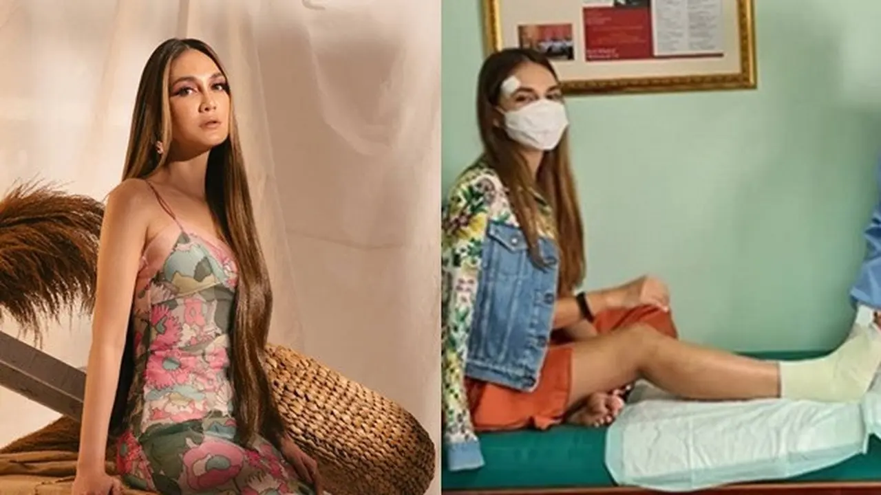 Alami Patah Tulang Metatarsal, Ini 6 Potret Kondisi Terbaru Luna Maya