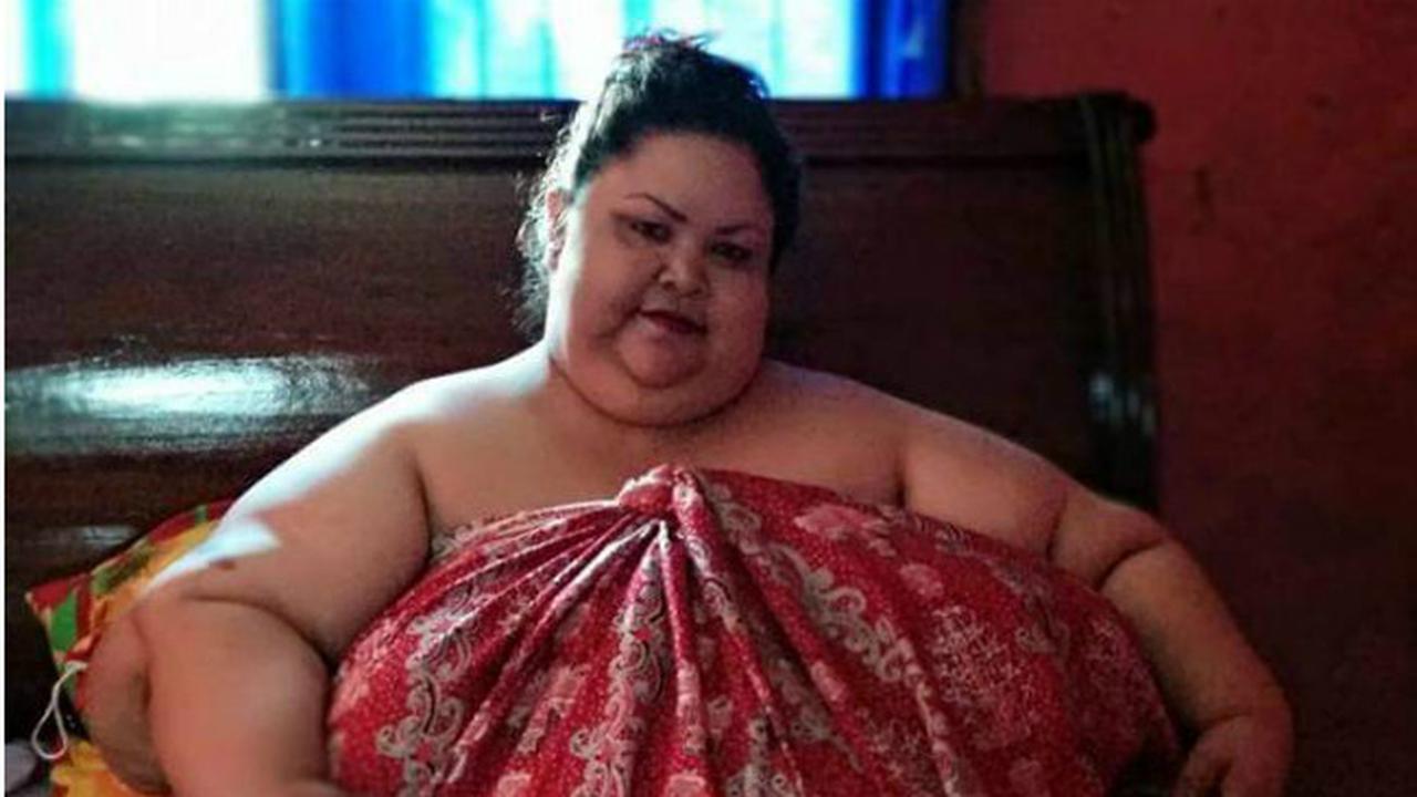 Pasca Operasi, Sejumlah Bagian Tubuh Titi Wati Tampak Mengendur