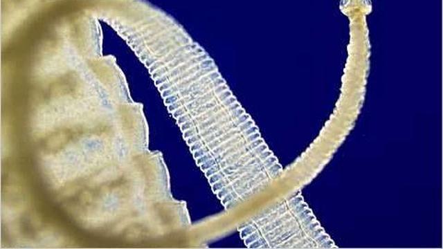 Infeksi Cacing Pita,Terjadi Tanpa Gejala