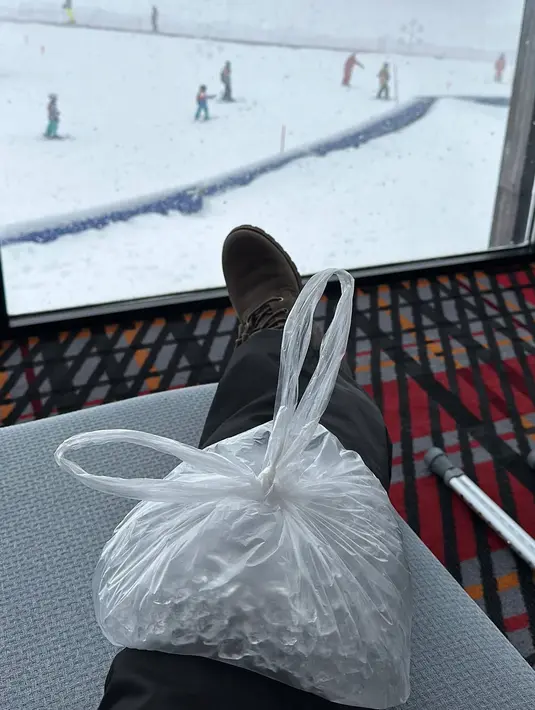 Mengalami kecelakaan saat bermain ski memang bisa terjadi kepada siapa saja. Marissa Nasution yang saat ini dirawat di rumah sakit pun menuai banyak ucapan doa dari para netizen yang mendoakan agar kondisinya lekas pulih. (Liputan6.com/IG/@marissaln)