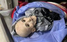 Kisah Pilu Bocah Gaza yang Meninggal Karena Kelaparan, "Tak Perlu Keajaiban Untuk Menyelamatkannya, Dia Hanya Butuh Makan!"